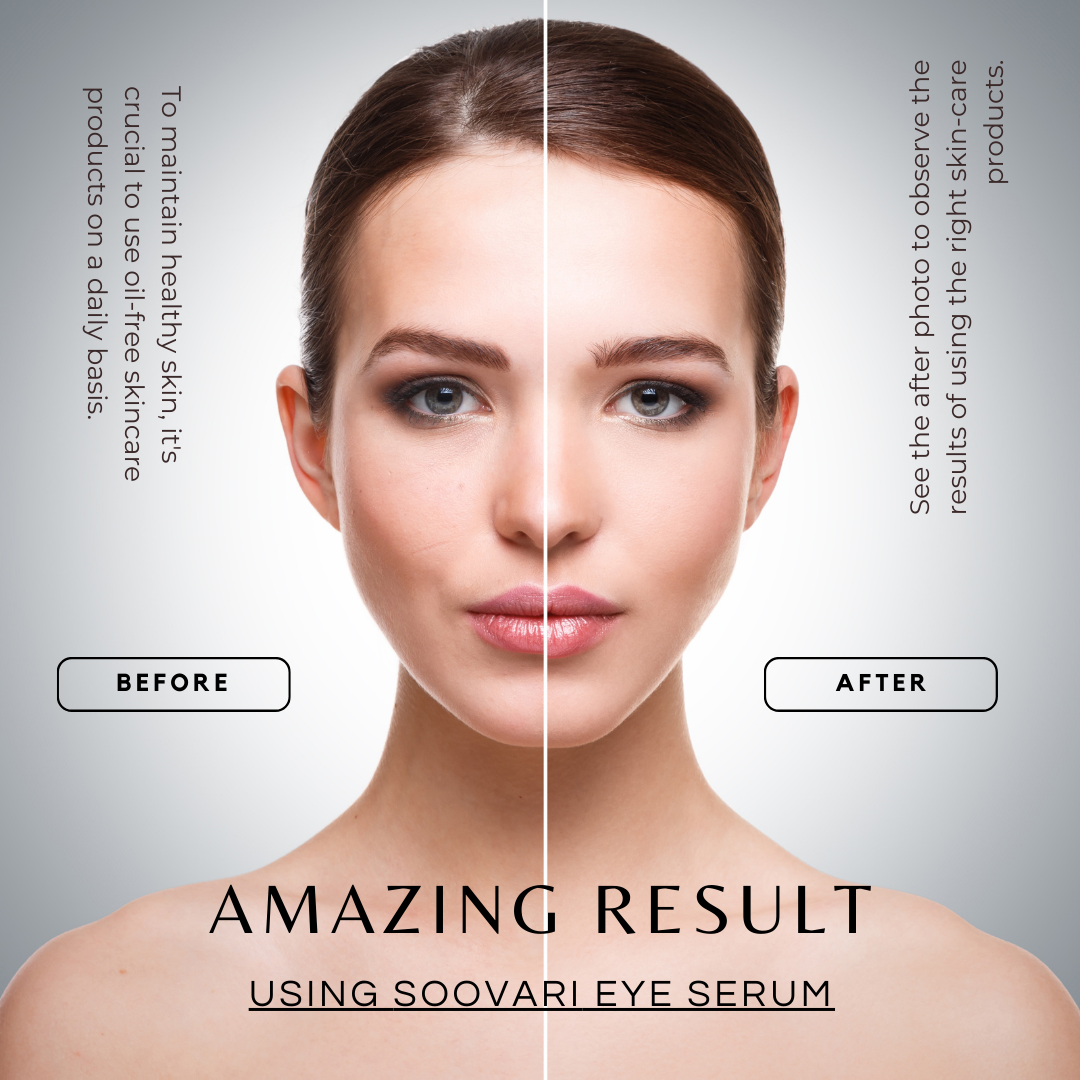 Unveiling Radiance: Transform Your Skincare Journey with SOOVARI's Moisturizing Oil-Free Anti-Aging Marvel